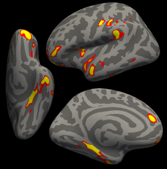 220307-covid-brain-scans-mn-1020-b9f3a7.jpg