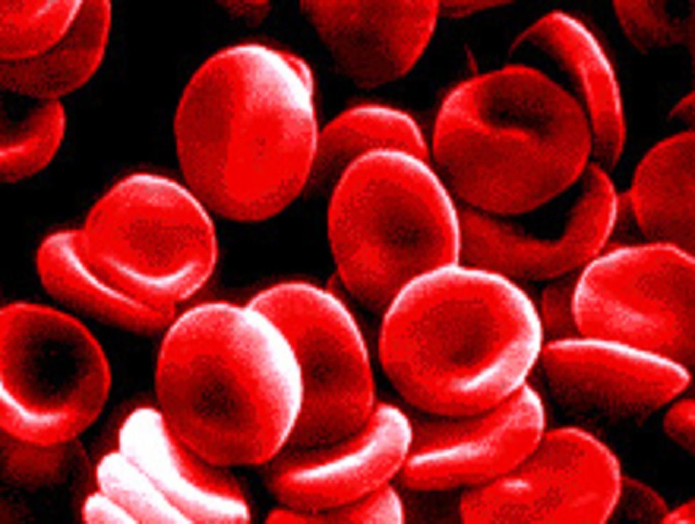 blood_cells20copy.jpg